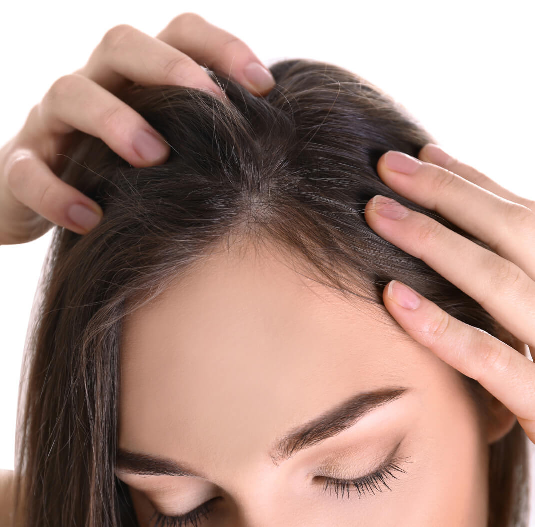 atopowe zapalenie skóry głowy