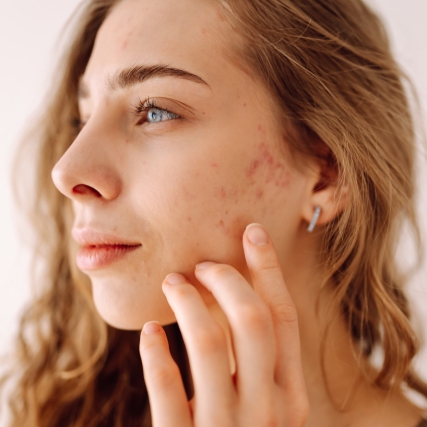 Jak hormony wpływają na kondycję skóry? 